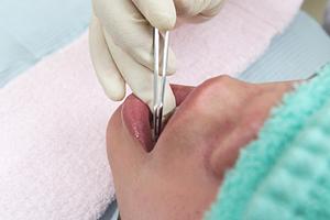 伊賀市でよい歯科を見つける方法