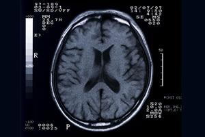 家族の健康を守る！蒲田で人気の歯科医院を徹底比較【予防歯科のポイント解説】